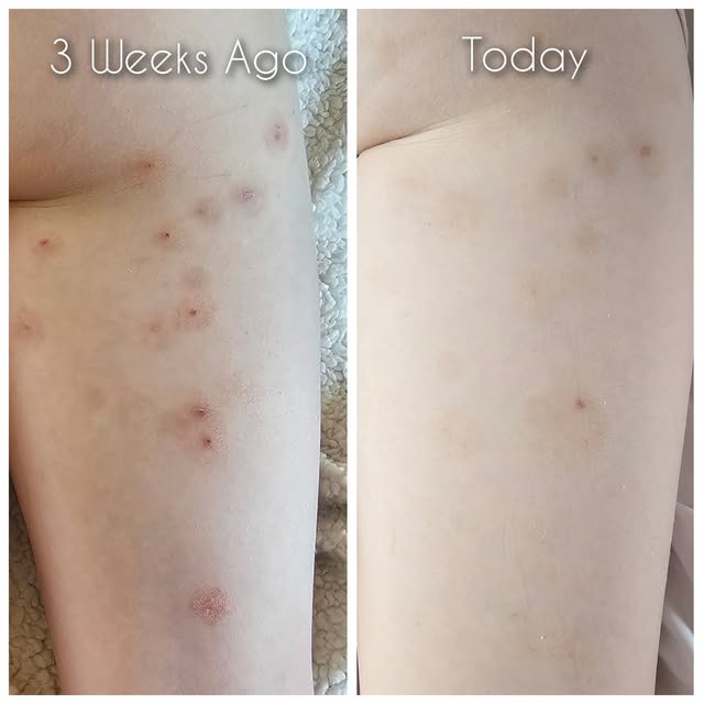 Before and after review for Mollenol.